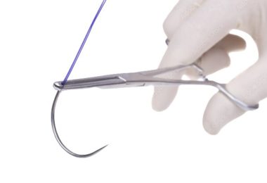 Suture advetis JPG Suture advetis JPG